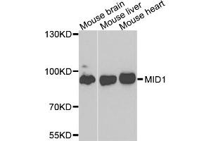 Western blot analysis of extracts of various cell lines, using MID1 antibody (ABIN4904369) at 1:1000 dilution. (MID1 抗体)
