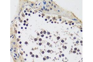 Immunohistochemistry of paraffin-embedded Rat testis using CCDC59 Polyclonal Antibody at dilution of 1:100 (40x lens). (CCDC59 抗体)