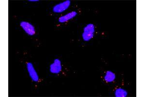 Proximity Ligation Analysis of protein-protein interactions between RICTOR and RPS6KB1. (RICTOR 抗体  (AA 1-265))