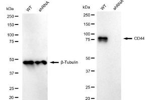 Western blotting analysis using CD44 antibody (ABIN7797973). (Recombinant CD44 抗体)