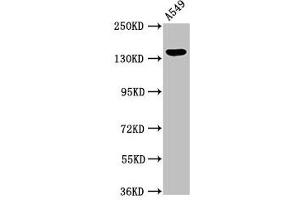 Western Blot Positive WB detected in: A549 whole cell lysate All lanes: PLIN4 antibody at 2. (PLIN4 抗体  (AA 308-418))