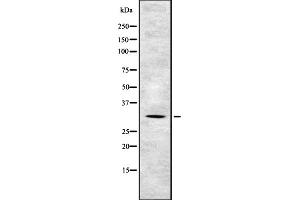 Western blot analysis of TSSC4 expression in HEK293 cells ,The lane on the left is treated with the antigen-specific peptide. (TSSC4 抗体  (C-Term))
