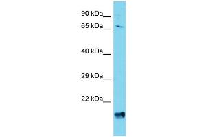 Host: Rabbit Target Name: AGAP4 Sample Type: HepG2 Whole Cell lysates Antibody Dilution: 1.