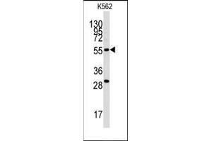 Western blot analysis of anti-CLIC5 Antibody in K562 cell line lysates (35ug/lane).