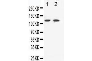 Anti-Eph receptor B3 antibody, Western blotting Lane 1: HELA Cell Lysate Lane 2: A549 Cell Lysate (EPH Receptor B3 抗体  (C-Term))