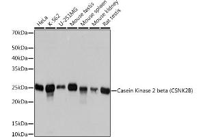 Western blot analysis of extracts of various cell lines, using Casein Kinase 2 beta (CSNK2B) (CSNK2B) Rabbit mAb (ABIN1680593, ABIN3019007, ABIN3019008 and ABIN7101698) at 1:1000 dilution. (CSNK2B 抗体)