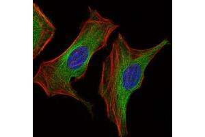 Immunocytochemistry (ICC) image for anti-Insulin-Like Growth Factor 2 (IGF2) (AA 25-180) antibody (ABIN1846026) (IGF2 抗体  (AA 25-180))