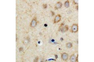Immunohistochemistry (IHC) image for anti-Protein Phosphatase 1, Regulatory (Inhibitor) Subunit 14A (PPP1R14A) (N-Term) antibody (ABIN7303384)