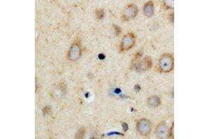 Immunohistochemical analysis of CPI17 staining in human brain formalin fixed paraffin embedded tissue section.