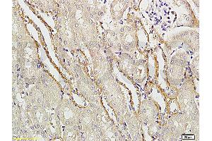 Formalin-fixed and paraffin embedded rat brain tissue labeled with Rabbit Anti-APG5L/ATG5 Polyclonal Antibody (ABIN752413) at 1:200 followed by conjugation to the secondary antibody and DAB staining. (ATG5 抗体  (AA 101-200))