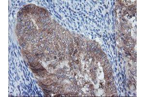 Image no. 7 for anti-Crystallin, Zeta, Homolog antibody (ABIN1497654)