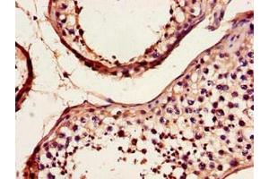 Immunohistochemistry of paraffin-embedded human testis tissue using ABIN7149322 at dilution of 1:100 (DYNC2H1 抗体  (AA 1928-2065))
