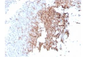 Formalin-fixed, paraffin-embedded human spleen stained with CD21 Recombinant Mouse Monoclonal Antibody (rCR2/1952). (Recombinant CD21 抗体  (AA 44-196))