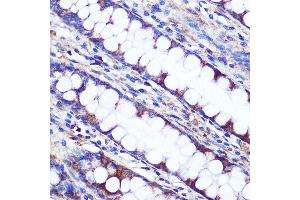 Immunohistochemistry (IHC) image for anti-LETM1 Domain Containing 1 (LETMD1) (AA 161-360) antibody (ABIN3023041)