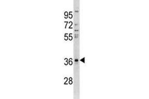 Anti-CTGF antibody western blot analysis in A549 lysate (CTGF 抗体  (AA 166-193))
