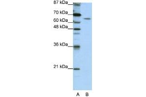 WB Suggested Anti-STAU1 Antibody Titration:  1. (STAU1/Staufen 抗体  (N-Term))