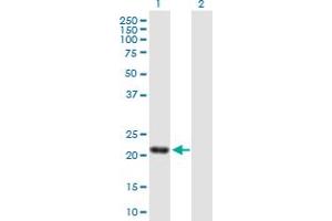 Western Blot analysis of SENP8 expression in transfected 293T cell line by SENP8 MaxPab polyclonal antibody. (SENP8 抗体  (AA 1-212))