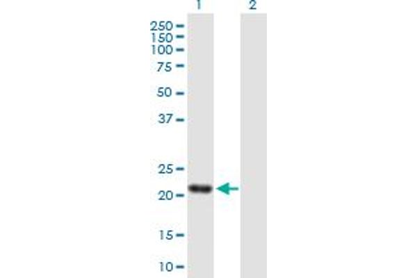 SENP8 抗体  (AA 1-212)