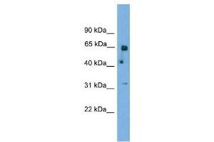 PNKP antibody used at 1 ug/ml to detect target protein. (PNKP 抗体  (N-Term))