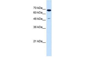 SILV antibody used at 1. (Melanoma gp100 抗体)
