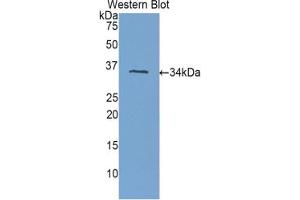 Western blot analysis of the recombinant protein. (PLXNB1 抗体  (AA 1780-2042))