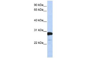 RanBP1 antibody used at 1 ug/ml to detect target protein. (RANBP1 抗体  (C-Term))