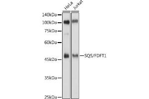Western blot analysis of extracts of various cell lines, using SQS/FDFT1 antibody (ABIN6130393, ABIN6140567, ABIN6140568 and ABIN6221824) at 1:500 dilution. (FDFT1 抗体  (AA 1-260))