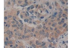 Immunohistochemistry (IHC) image for anti-Killer Cell Lectin-Like Receptor Subfamily B, Member 1 (KLRB1) (AA 73-188) antibody (ABIN7439978)