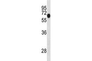 Dyrk1b antibody western blot analysis in mouse lung tissue lysate. (DYRK1B 抗体  (AA 376-403))