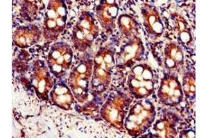 Immunohistochemistry (IHC) image for anti-Solute Carrier Family 7 (Cationic Amino Acid Transporter, Y+ System), Member 6 (SLC7A6) (AA 473-515) antibody (ABIN7175937)