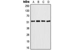 Western blot analysis of ATF2 expression in HeLa (A), NIH3T3 (B), PC12 (C), rat brain (D) whole cell lysates. (ATF2 抗体  (Center))