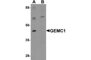Western blot analysis of GEMC1 in mouse heart tissue lysate with GEMC1 antibody at 1 μg/mL in (A) the absence and (B) the presence of blocking peptide (GEMC1 抗体  (Center))