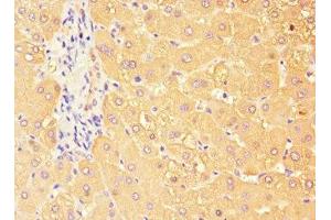 Immunohistochemistry of paraffin-embedded human liver tissue using ABIN7171658 at dilution of 1:100 (TBC1D7 抗体  (AA 1-293))