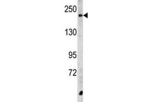 Western blot analysis of CPD antibody and HeLa lysate. (CPD 抗体  (AA 1019-1048))