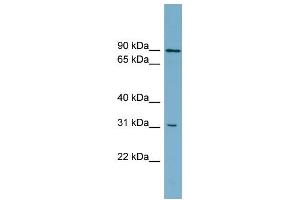 WB Suggested Anti-ABCD2 Antibody Titration:  0. (CCL17 抗体  (Middle Region))