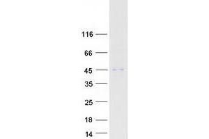 Western Blotting (WB) image for Abhydrolase Domain Containing 12 (ABHD12) (Transcript Variant 1) protein (Myc-DYKDDDDK Tag) (ABIN2714272)