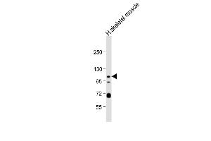Anti-KCNQ5 Antibody (C-term) at 1:1000 dilution + human skeletal muscle lysate Lysates/proteins at 20 μg per lane. (KCNQ5 抗体  (C-Term))
