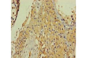 Collagen, Type VI, alpha 6 (COL6A6) (AA 430-982) 抗体