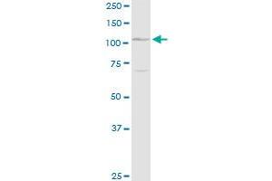 DSG1 MaxPab rabbit polyclonal antibody. (Desmoglein 1 抗体  (AA 1-1049))