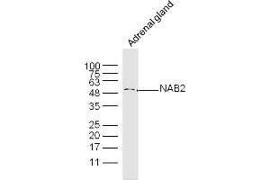 Mouse adrenal Gland lysates probed with NAB2 Polyclonal Antibody, Unconjugated  at 1:300 dilution and 4˚C overnight incubation. (NAB2 抗体  (AA 221-320))