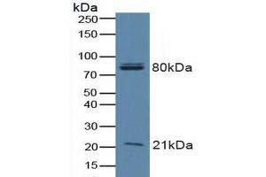 Western blot analysis of Human A549 Cells. (BAD 抗体  (AA 1-168))
