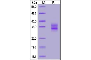 SDS-PAGE (SDS) image for Folate Receptor 1 (Adult) (FOLR1) (AA 25-232) (Active) protein (His tag) (ABIN5526656)