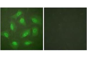 Immunofluorescence analysis of HeLa cells, using JAB1 Antibody. (COPS5 抗体  (AA 374-423))