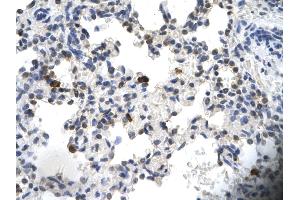 Rabbit Anti-PCYOX1 Antibody       Paraffin Embedded Tissue:  Human alveolar cell   Cellular Data:  Epithelial cells of renal tubule  Antibody Concentration:   4. (PCYOX1 抗体  (C-Term))