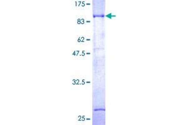 Dystrobrevin beta Protein (AA 1-560) (GST tag)