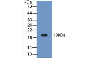 Western blot analysis of recombinant Human FADS2. (FADS2 抗体  (AA 1-130))