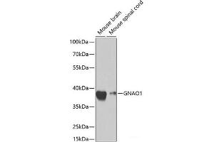 Western blot analysis of extracts of various cell lines using GNAO1 Polyclonal Antibody at dilution of 1:1000. (GNAO1 抗体)