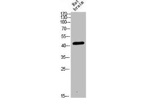 Western blot analysis of RAT-BRAIN Cell Lysate, antibody was diluted at 1:1000. (CRHR2 抗体  (AA 1268-1341))