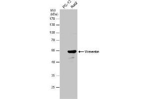 Vimentin 抗体