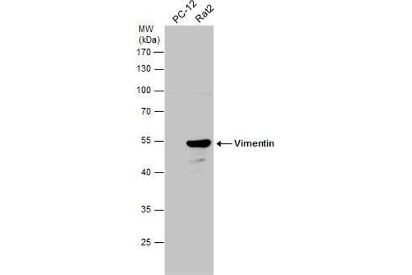 Vimentin 抗体